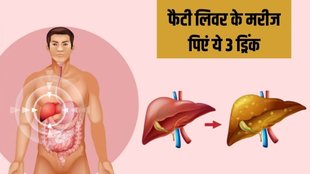 Fatty Liver Thik Karne ke liye Kya Kare, Fatty Liver, Naturally Manage Fatty Liver, fatty liver kaise thik kare