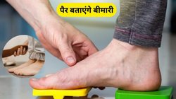 आपकी ओवर ऑल हेल्थ का राज छिपा है आपके पैरों में, किडनी से लेकर लिवर की सेहत भी बताते हैं फुट, एक्सपर्ट से जानिए