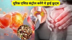 यूरिक एसिड नहीं हो रहा कंट्रोल तो इन 5 ड्राई फ्रूट्स को खाना कर दें शुरू, गठिया का दर्द भी हो जाएगा छूमंतर