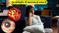 गुड कोलेस्ट्रॉल भी हो सकता है घातक, आंखों पर पड़ता है सबसे ज्यादा असर, रिसर्च से हुआ चौंकाने वाला खुलासा, जानिए कैसे करें बचाव