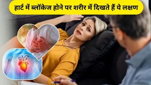 blockage in the heart, heart blockage symptoms, heart blockage symptoms and signs, coronary artery disease, artery disease