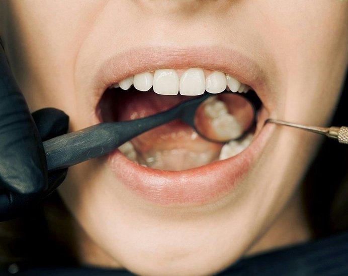 sunflower oil pulling