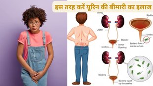 urination problems in males hindi, urination problems after turp surgery, urination problems after prostate removal