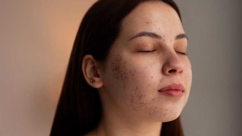 how to remove dark pigmentation