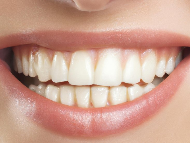 Acidic foods and teeth