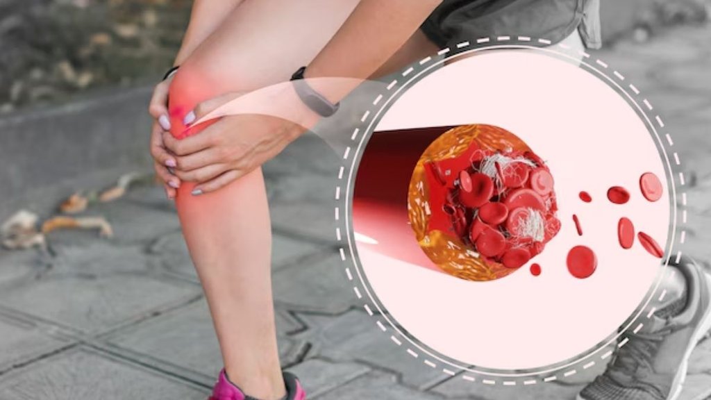 Symptoms of High Cholesterol While Walking, High Cholesterol Symptoms While Walking, cholesterol causes and cure, cholesterol kaise control kare in hindi