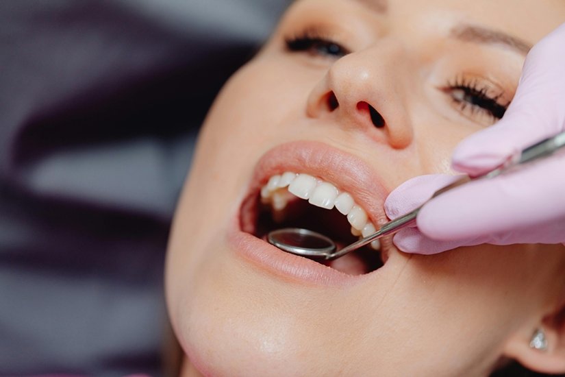 Plaque removal