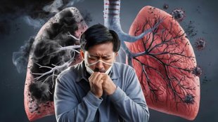 Tuberculosis, Mycobacterium Tuberculosis, Bacteria, TB, vitamin, these vitamin deficiency increases risk of tuberculosis, TB causes, TB symptoms, TB treatment, TB causes symptoms and treatment