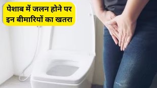 burning during urination causes, burning in urine causes male, painful urination reasons, 5 diseases of burning during urination, burning during urination, burning urination