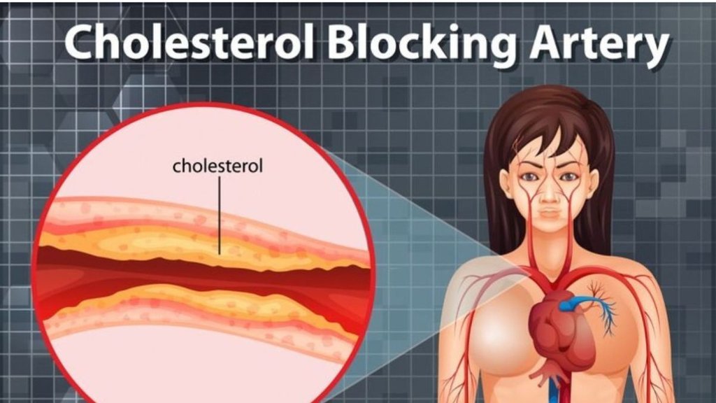 reverse cholesterol diet, polyphenols,pecans benefits,nutritional standards,nut consumption,lower cholesterol,heart-healthy snacks,healthy diet,