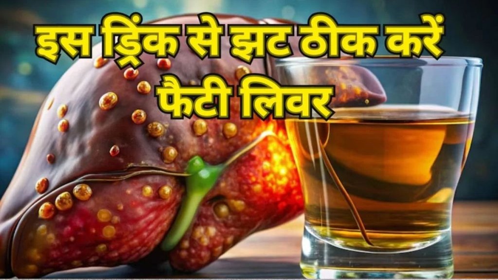 Fatty Liver Drink, fatty liver control drink, fatty liver tips, fatty liver ko kaise kam kare in hindi, fatty liver ko kaise kam kare, fatty liver, Coriander and Cardamom Tea benefits