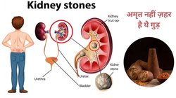 क्या किडनी के लिए गुड़ ज़हर है? इतनी हेल्दी चीज क्यों बन जाती है टॉक्सिन, सच्चाई जान हिल जाएंगे आप