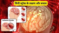 Mini Stroke: जब हो जाता है दिमाग में खून जाना बंद? इन 5 संकेत से पता चलेगा मिनी स्ट्रोक का खतरा