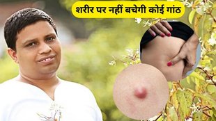 kachnar for lumps, kachnar remove all lumps, Kanchnar Guggal for Lipoma, Kanchnar Guggal, Cysts, Tumors, Lipoma, Bauhinia variegata, kachnar benefits