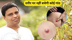 Ganth Ka Ilaj: शरीर से सारी गांठ को खत्म कर देगी ये दिव्य औषधि, आचार्य बालकृष्ण ने बताया कैसे करें उपयोग