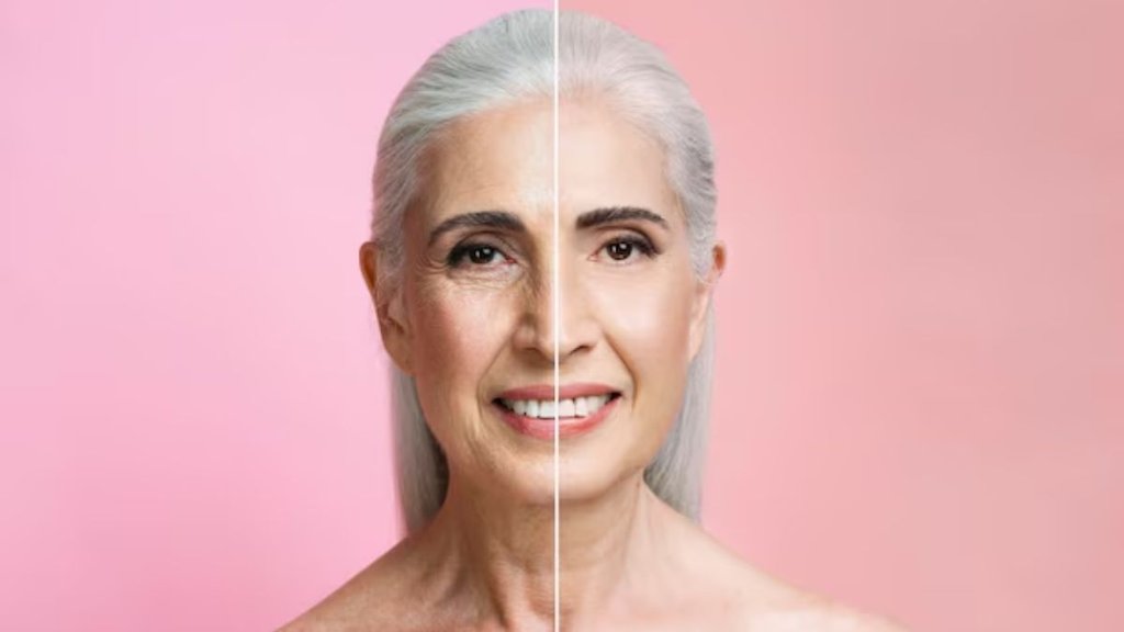 remove wrinkles from face। How to remove wrinkles। wrinkles on face