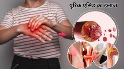 Uric Acid का काल हैं ये काले बीज, जोड़ों में जमे कंकड़ हफ्ते भर में निकल जाएंगे बाहर, जानिए कैसे करें इस्तेमाल