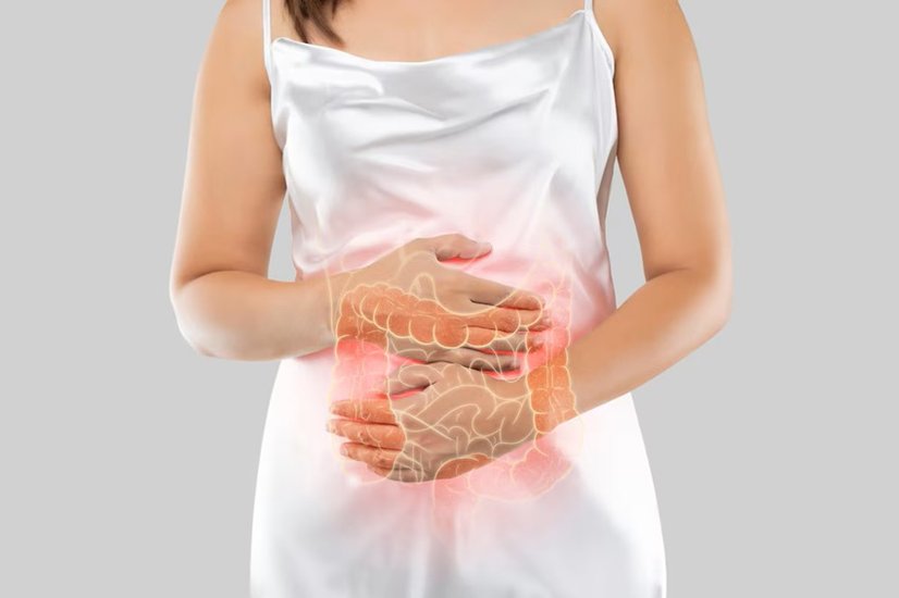 Colitis