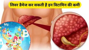 Deficiency of these vitamins can damage the liver, liver damage, these vitamins can damage liver, Liver Health