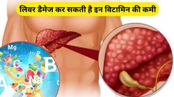 Liver Health: लिवर को बर्बाद कर देंगे ये विटामिन, कभी भी नहीं होने दे कमी, जानिए कैसे