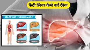 Fatty Liver