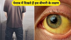 पेशाब में दिखाई देते हैं गर्मी में ज्यादा होने वाली इस गंभीर बीमारी के लक्षण, आचार्य बालकृष्ण से जानिए बचाव और कारण
