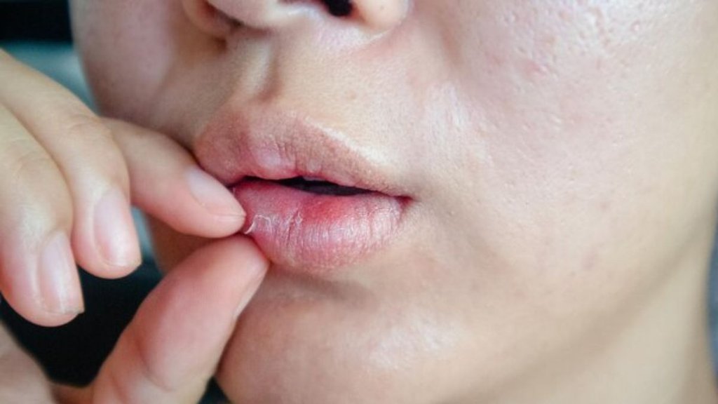 How to cure chapped lips fast । Lips Care ।cure chapped lips tips