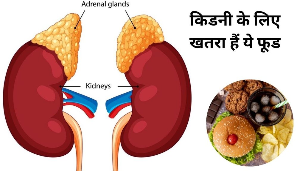 kidney, kidney ailments, kidneys, foods high in oxalate, foods you should avoid kidney issues, food, foods you should not consume,