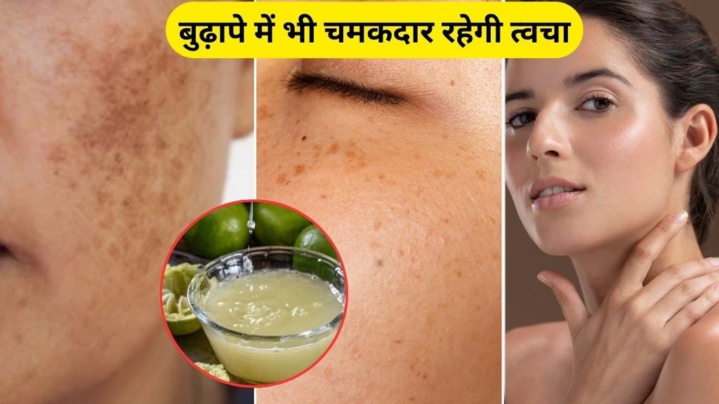 Skin care tips, Skin pigmentation, Skin problems, Home Remedies for Pigmentation, Permanent scar removal at home, How to remove old scars