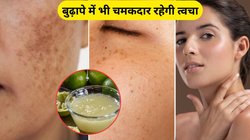 कम उम्र में ही चेहरे पर पड़ गए धब्बे तो इन 3 घरेलू नुस्खों वापस आ जाएगी खूबसूरती, जानिए कैसे