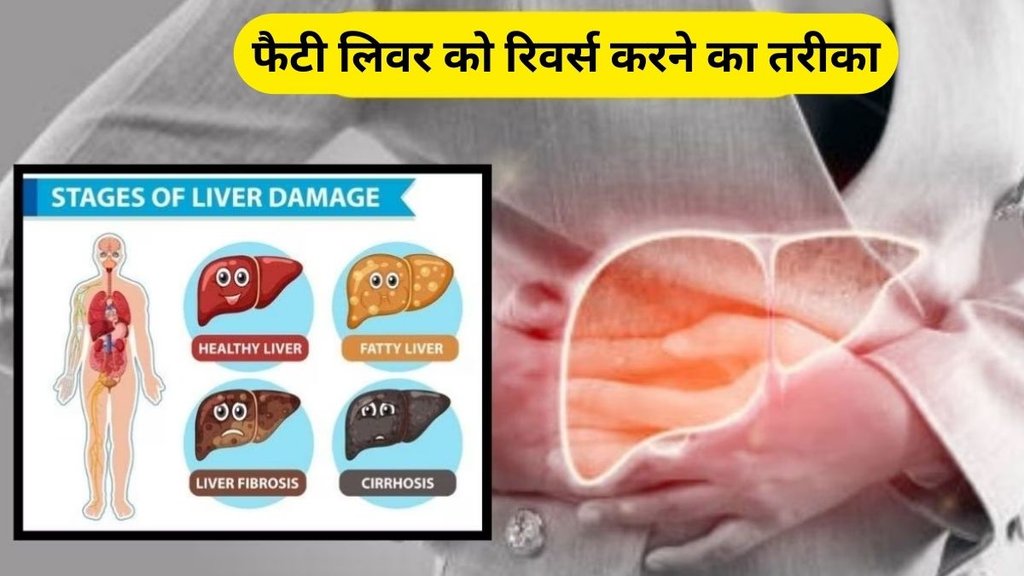 reverse fatty liver, fatty liver, liver, how to reverse fatty fiver, 5 best tips to reverse fatty liver in hindi, best tips to reverse fatty liver
