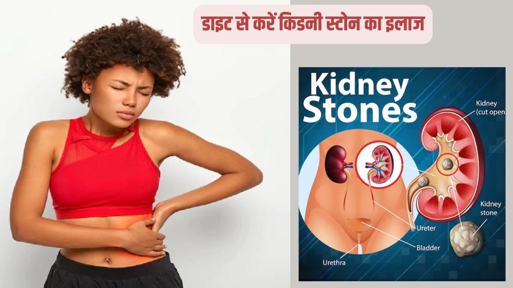 what causes kidney stones,symptoms of kidney stones,prevent kidney stones,kidney stones,kidney stone treatment