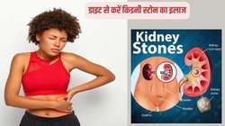 Kidney Stones होने पर शुरुआत में दिखाई देते हैं ये 3 लक्षण, बीमारी पनपने में ये 8 कारण हैं जिम्मेदार, जानिए बचाव का तरीका