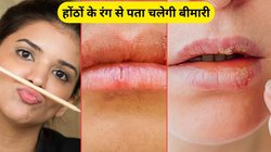 होंठों का रंग खोलता है सेहत के कई राज, जानिए सफेद-काले और फटे होंठ किस बीमारी के हैं संकेत