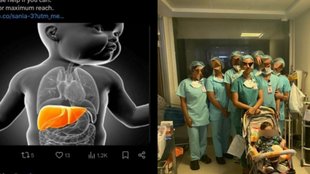 mother donate liver part to son
