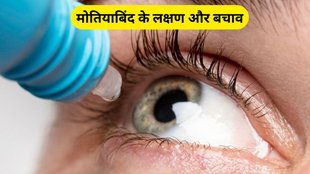 eye health tips, sharpen eyesight naturally, how to improve eyesight in hindi, how to improve eyesight, improve eyesight, eyesight reasons, What is Cataract Disease, Cataract Disease