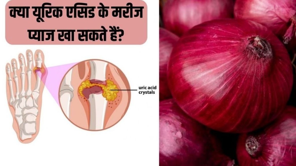 Uric Acid Control, Uric Acid, Control Uric Acid, How To Control Uric Acid, onion in uric acid, onion benefits for uric acid, onion benefits, benefits of onion in uric acid