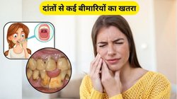 दांतों से खून, मसूड़े फूलने और बदबू से हैं परेशान तो इन 3 चीजों को खाना कर दें शुरू, जानिए बचाव