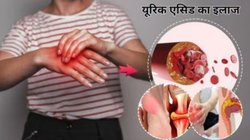 यूरिक एसिड बढ़ने से उंगलियां टेढ़ी- मेढ़ी हो गई और पड़ गई हैं गांठें, इन 5 फ्रूट्स को रोज़ खाएं, सूजन और दर्द हो जाएगा कंट्रोल