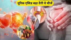 इन 5 कारणों से बढ़ने लगता है यूरिक एसिड, जानिए कंट्रोल करने के उपाय