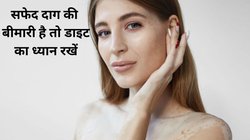 Vitiligo Diet Chart: बॉडी पर क्यों होते हैं सफेद दाग, स्किन की इस परेशानी से छुटारा पाने के लिए कैसी होनी चाहिए डाइट, देखिए डाइट चार्ट