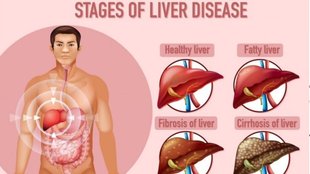 walnuts and liver inflammation,turmeric liver detox,nut health benefits liver,liver health,green tea liver benefits,foods to improve liver function,foods for liver detox