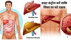 लिवर में खराबी होने पर पैरों में दिखाई देते हैं ये 6 लक्षण, पंजों में ये दिखें तो तुरंत हो जाइए सतर्क, देखिए सिम्पटम