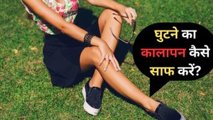 How to get rid of dark knees quickly | ghutne ka kalapan kaise hataye | lighten dark knee home remedies in hindi