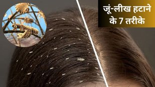 How to remove lice from hair permanently | How to get rid of lice naturally | jue kaise hataye