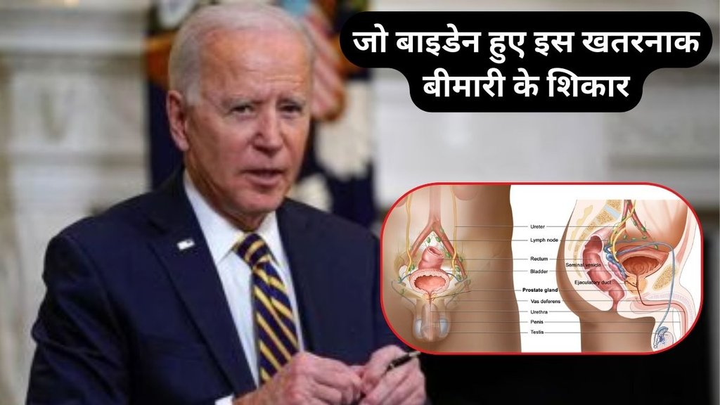 prostate cancer symptoms, prostate cancer causes, prostate cancer early signs, prostate cancer reasons, Prostate Cancer, Joe Biden Prostate Cancer, Joe Biden, Joe Biden health new