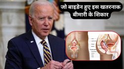 अमेरिका के पूर्व राष्ट्रपति Joe Biden को हुआ Prostate Cancer, हड्डियों को अंदर से खोखला बना देती है ये बीमारी, जानिए बॉडी में कौन से दिखते हैं लक्षण और क्या है इलाज