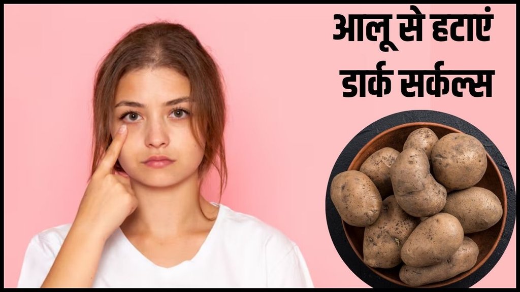 Potatoes for Dark Circles, aalu se dark circle kaise hataye