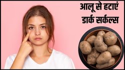 आलू से आंखों के डार्क सर्कल्स कैसे हटाएं? कालापन दूर करने के लिए इस तरह करें उपयोग