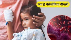 World Thalassemia Day 2025: ये कैसी बीमारी है जिसमें बच्चों का सूखने लगता है खून, होने लगती हैं गंभीर परेशानियां, जानिए बीमारी क्या है, लक्षण और बचाव का तरीका